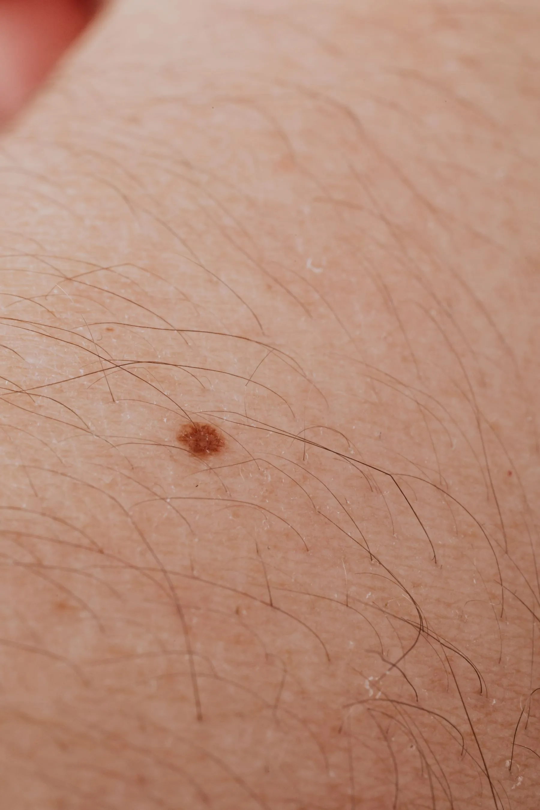 Pinta na pele vista de muito perto, com os pelos ao redor